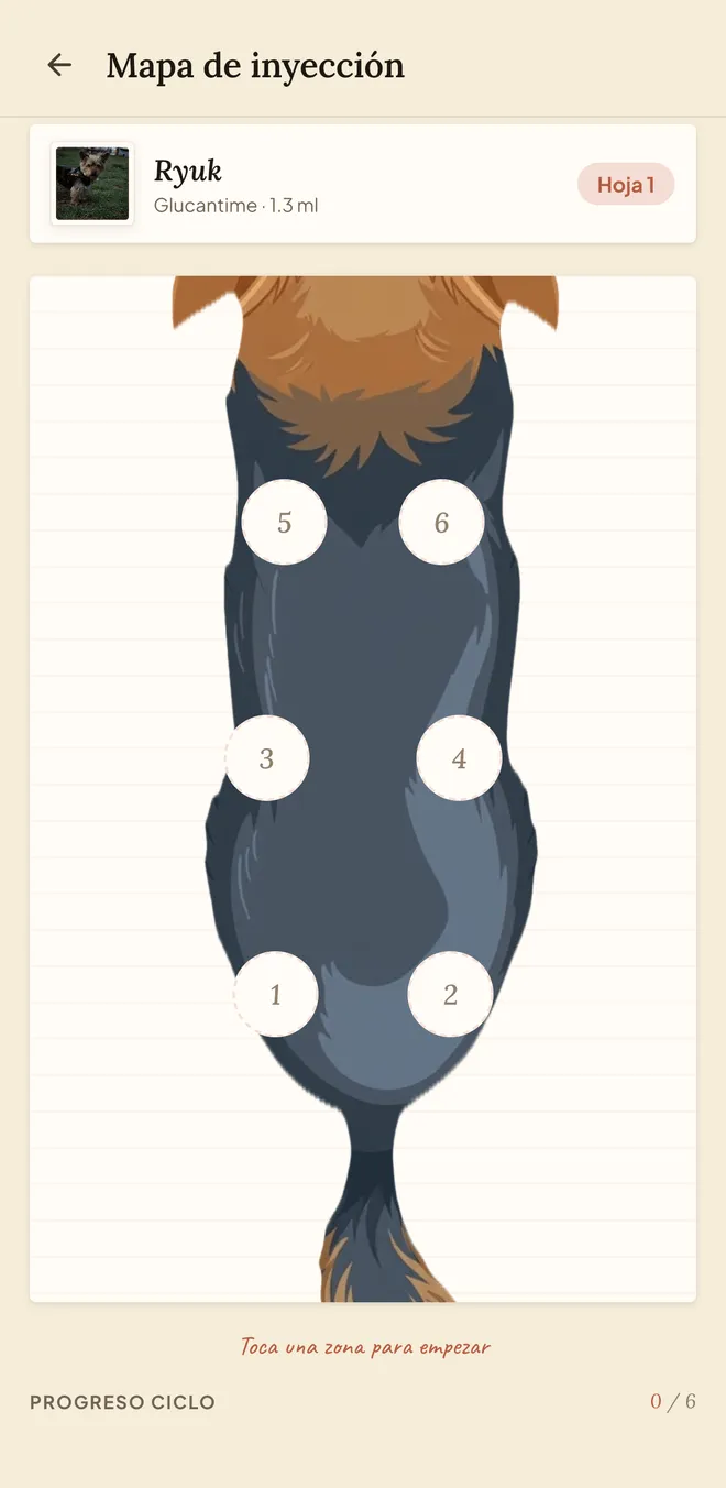 Mapa de Inyecciones